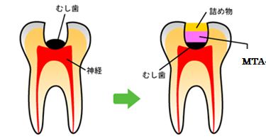 鎮静法